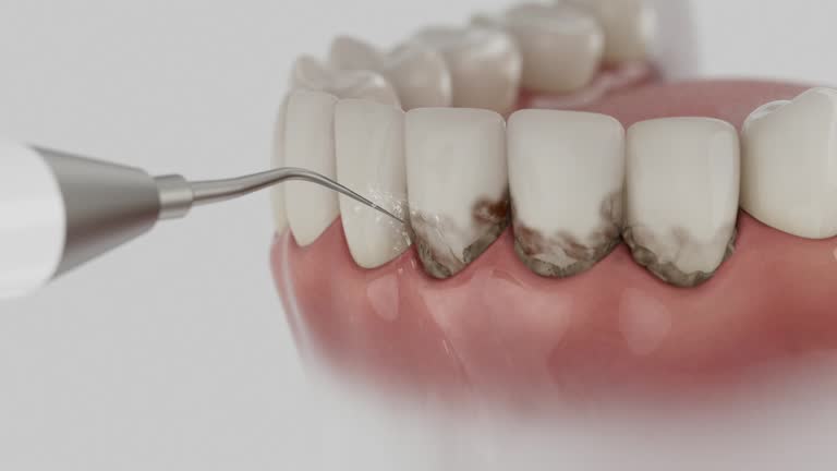 Trusted Emergency Dentist service in Carrollton, OH - Dentist Open Now